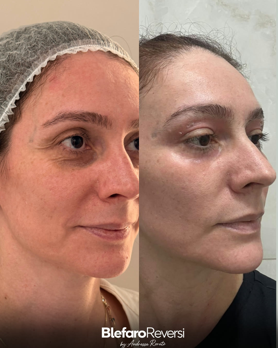 Caso 3 da prática clínica da Dra. Andressa Rorato, antes e depois